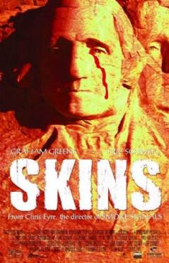 Skins(2002) Movies